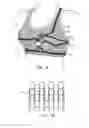 Fig. 05 - SELF-MEASURING GARMENT