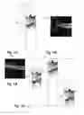 Fig. 04 - Method for the analysis of image data representing a three-dimensional volume of biological tissue