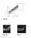 Fig. 05 - Method for the analysis of image data representing a three-dimensional volume of biological tissue