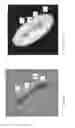 Fig. 04 - Image Analysis in the Presence of a Medical Device