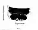 Fig. 09 - METHOD AND SYSTEM FOR HEAD DIGITIZATION AND CO-REGISTRATION OF MEDICAL IMAGING DATA
