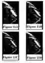 Fig. 16 - Apparatus and method for visualizing digital breast tomosynthesis and other volumetric images
