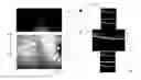 Fig. 01 - USER INTERFACE FOR EFFICIENTLY DISPLAYING RELEVANT OCT IMAGING DATA