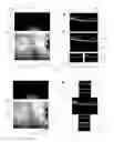 Fig. 02 - USER INTERFACE FOR EFFICIENTLY DISPLAYING RELEVANT OCT IMAGING DATA
