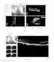 Fig. 03 - USER INTERFACE FOR EFFICIENTLY DISPLAYING RELEVANT OCT IMAGING DATA