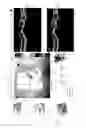 Fig. 07 - USER INTERFACE FOR EFFICIENTLY DISPLAYING RELEVANT OCT IMAGING DATA