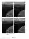 Fig. 10 - Method and Apparatus For Generating an Ultrasound Scatterer Representation