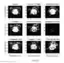 Fig. 11 - Method and Apparatus For Generating an Ultrasound Scatterer Representation