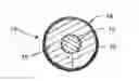 Fig. 01 - Metal-plated music string