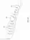 Fig. 22 - Adjustable and foldable shoulder rest for violin or viola