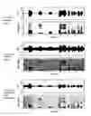 Fig. 01 - Method and system for suppressing noise in speech signals in hearing aids and speech communication devices