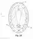 Fig. 05 - Plasma systems and methods of processing using thereof