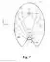 Fig. 11 - Plasma systems and methods of processing using thereof