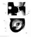 Fig. 01 - Antenna for appendage-worn miniature communications device