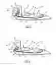 Fig. 03 - Optimal camera and antenna integration