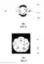 Fig. 03 - Radial antenna and methods for use therewith