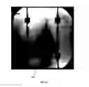Fig. 03 - Method and system for testing indirect bandgap semiconductor devices using luminescence imaging