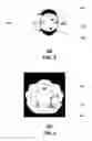 Fig. 03 - Method and apparatus for communications management in a neighborhood network