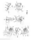 Fig. 04 - Earpiece positioning and retaining
