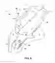 Fig. 07 - Earpiece positioning and retaining