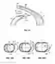 Fig. 09 - Support structures for a flexible electronic component