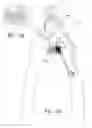 Fig. 04 - Illuminated nail clipper