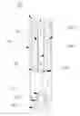 Fig. 01 - ATOMIZER AND ELECTRONIC CIGARETTE