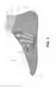 Fig. 03 - Multi-layered braided article and method of making