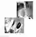 Fig. 06 - DRESSING ASSISTANCE APPARATUS AND METHOD