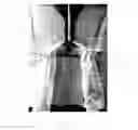 Fig. 08 - DRESSING ASSISTANCE APPARATUS AND METHOD