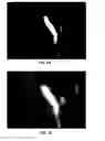 Fig. 07 - STEREOSCOPIC ENDOSCOPE SYSTEM WITH CONCURRENT IMAGING AT VISIBLE AND INFRARED WAVELENGTHS