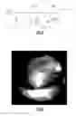 Fig. 07 - Digital otoscope