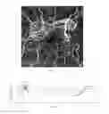 Fig. 06 - Enhanced vessel characterization in optical coherence tomograogphy angiography