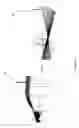 Fig. 25 - Wide-field retinal imaging system