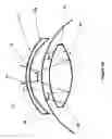 Fig. 28 - Wide-field retinal imaging system
