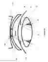 Fig. 31 - Wide-field retinal imaging system