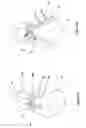 Fig. 33 - Wide-field retinal imaging system