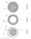 Fig. 34 - Wide-field retinal imaging system