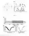 Fig. 04 - Non-cartesian retrospective reconstruction of cardiac motion in patients with severe arrhythmia