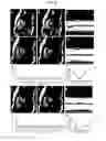 Fig. 06 - Non-cartesian retrospective reconstruction of cardiac motion in patients with severe arrhythmia