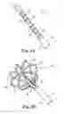 Fig. 03 - Deployment control apparatus for a catheter with a deployable array