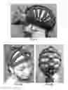 Fig. 08 - PORTABLE BRAIN ACTIVITY SENSING PLATFORM FOR ASSESSMENT OF VISUAL FIELD DEFICITS