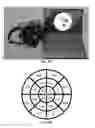 Fig. 09 - PORTABLE BRAIN ACTIVITY SENSING PLATFORM FOR ASSESSMENT OF VISUAL FIELD DEFICITS