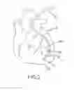 Fig. 03 - Respiratory-based control of medical procedure