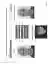 Fig. 07 - SKIN ASSESSMENT DEVICE