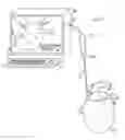 Fig. 01 - CATHETER WITH INDUCTIVE FORCE SENSING ELEMENTS