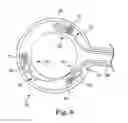 Fig. 08 - CATHETER WITH INDUCTIVE FORCE SENSING ELEMENTS
