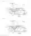 Fig. 11 - Subject-information acquisition apparatus