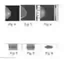 Fig. 04 - Device and method for tomosynthesis imaging