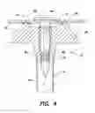 Fig. 04 - Implantable bone marrow access apparatus